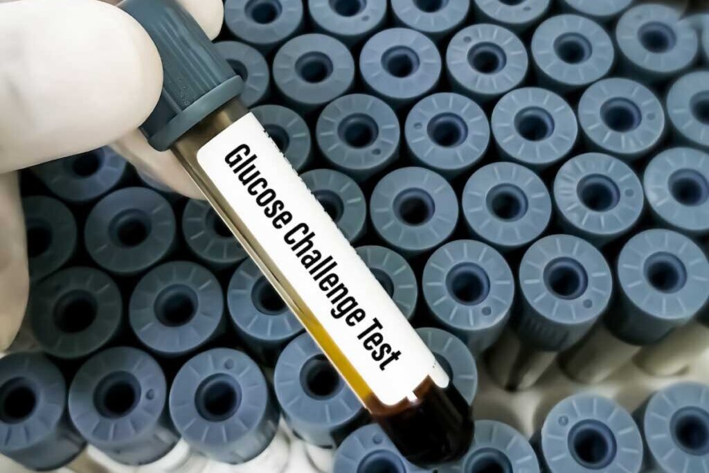 A blood sample for a glucose challenge test.