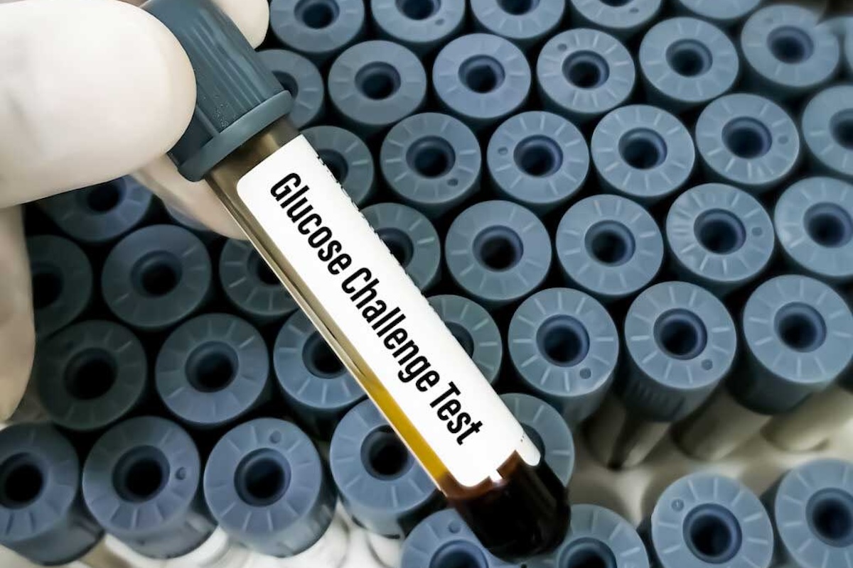 A blood sample for a glucose challenge test.