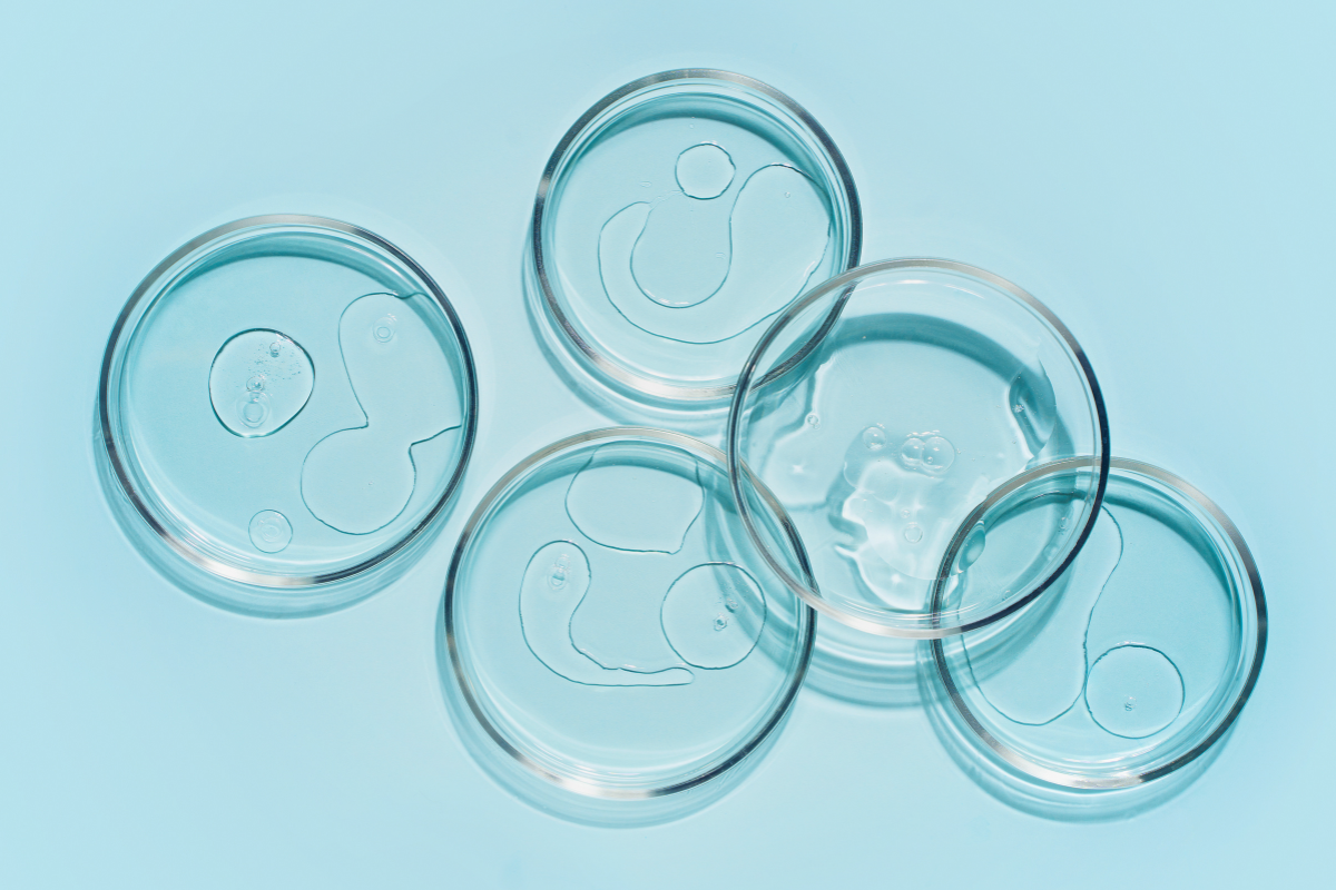 Liquid in several petri dishes on a blue background.