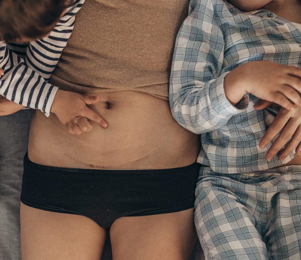 A parent with a c-section scar lies down with two children, one of whom is touching the scar.