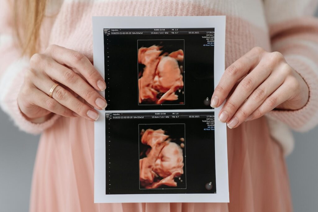 Pregnant person wearing pink holding ultrasound in front of their belly.