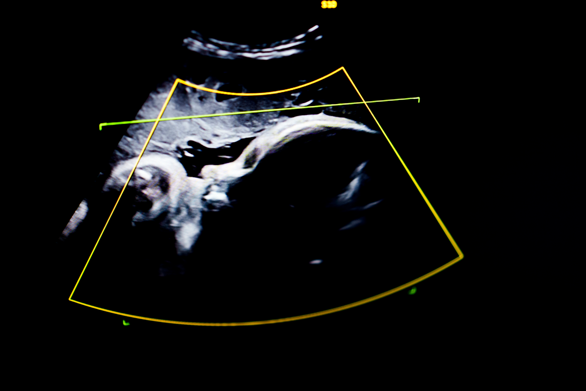 View of a baby's head during a 37-week ultrasound.