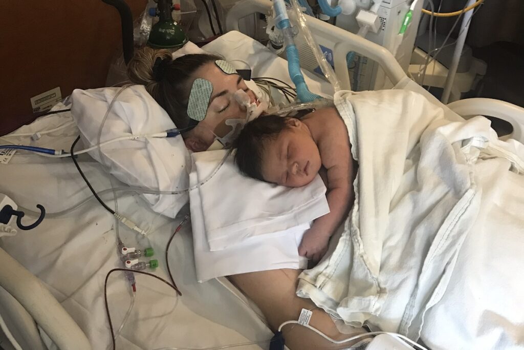 Parent in hospital bed hooked up to machines with newborn lying on their chest