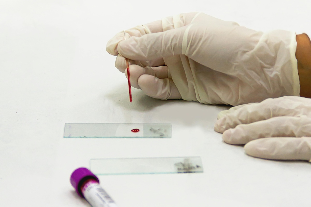 Gloved hand doing a blood test