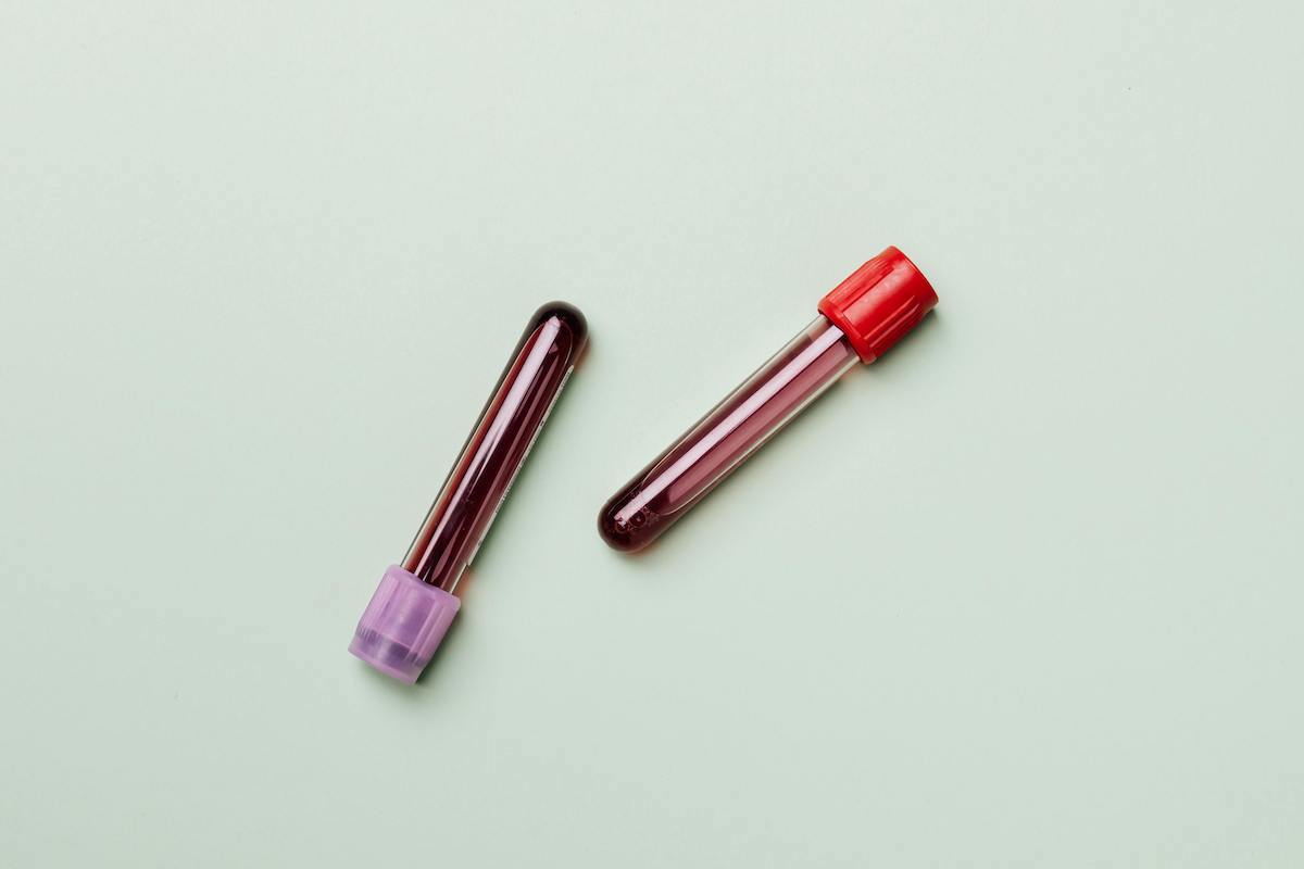 Two test tubes having blood.