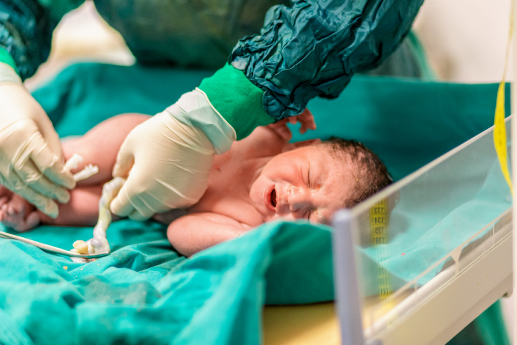 A doctor clamping the umblical cord of a newborn after delivery.